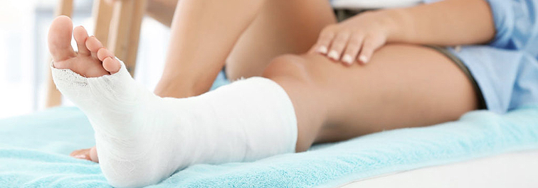 Jeune femme allongée avec jambe dans le plâtre.